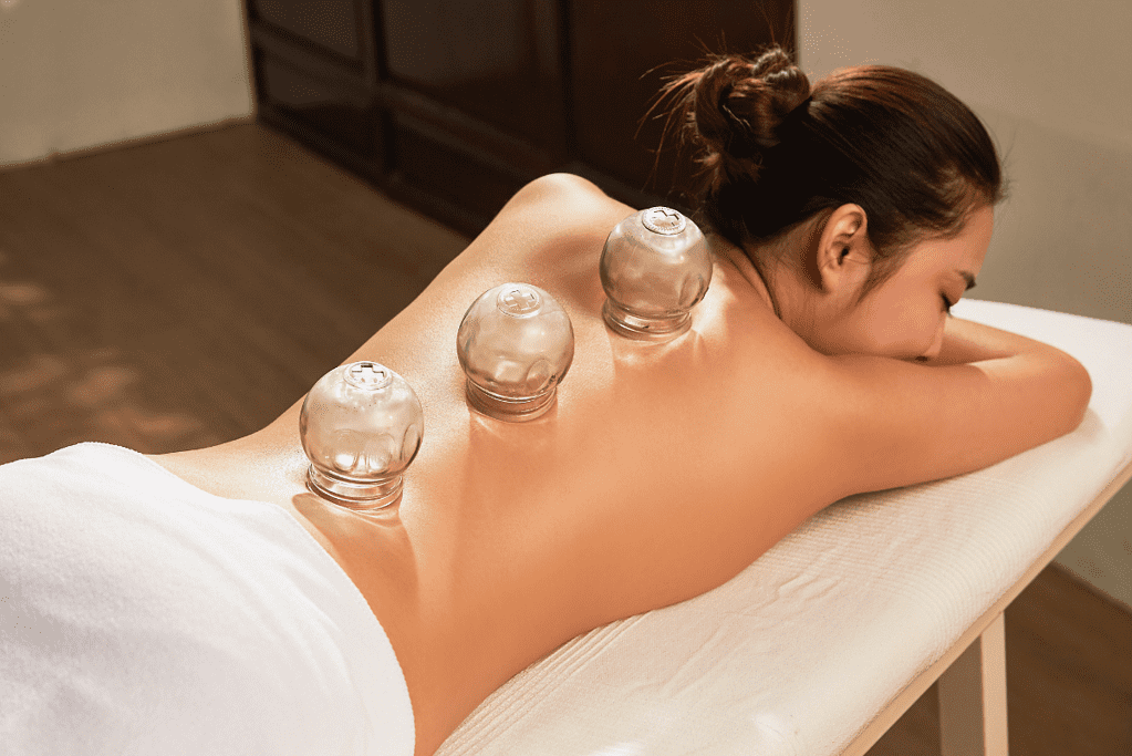 woman getting cupping